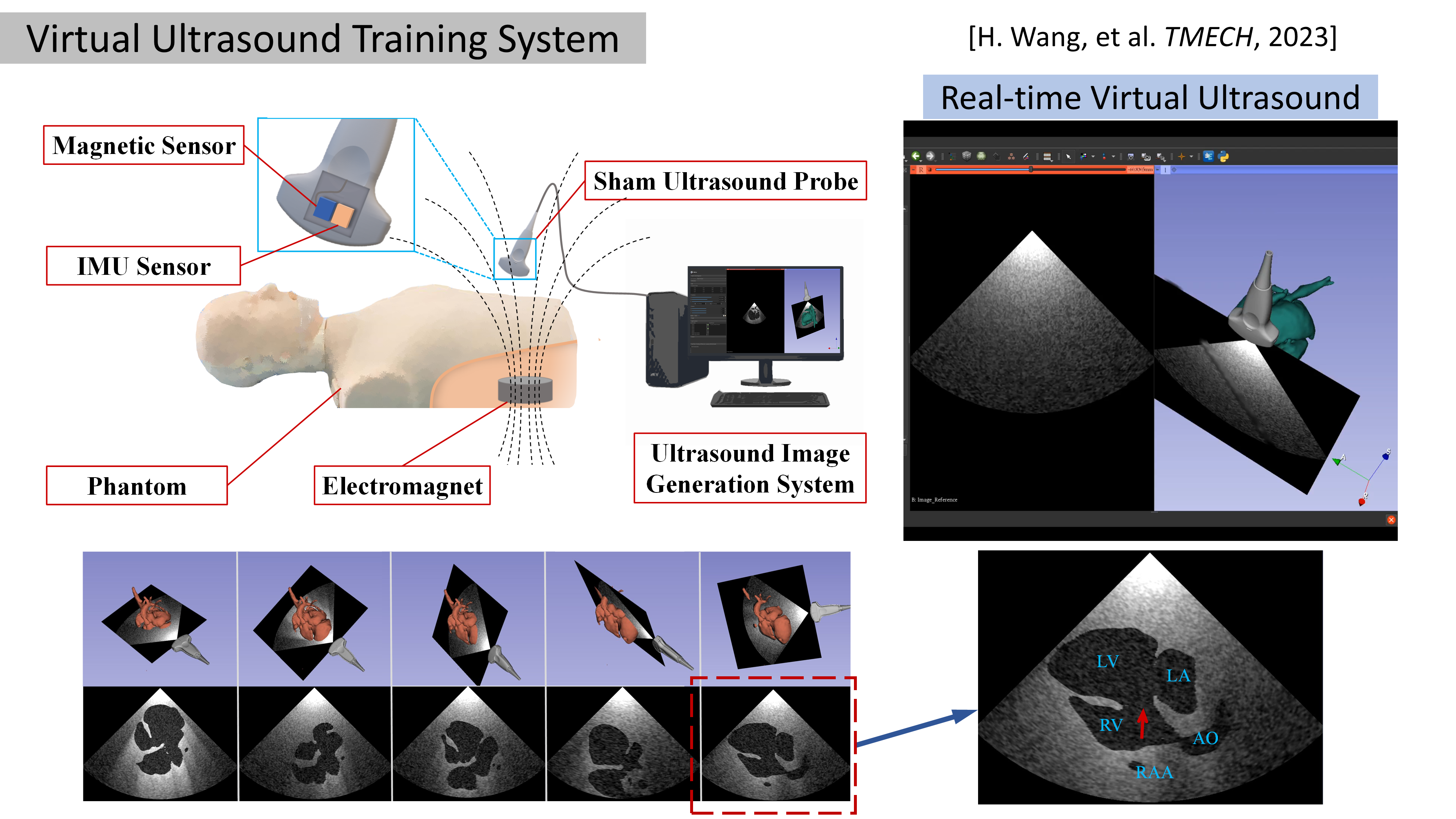 virtual ultrasound